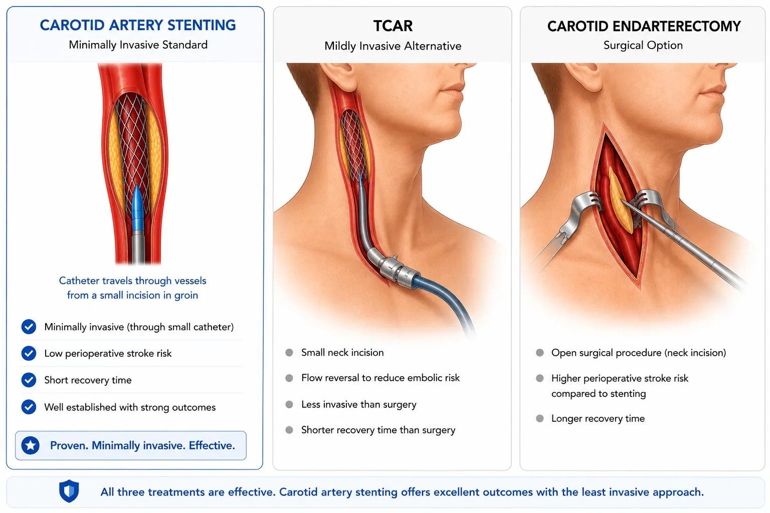 Carotid artery treatment options