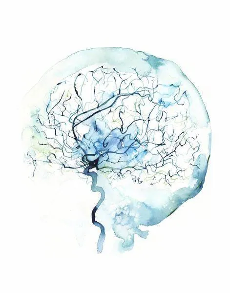 Cerebral Angiography